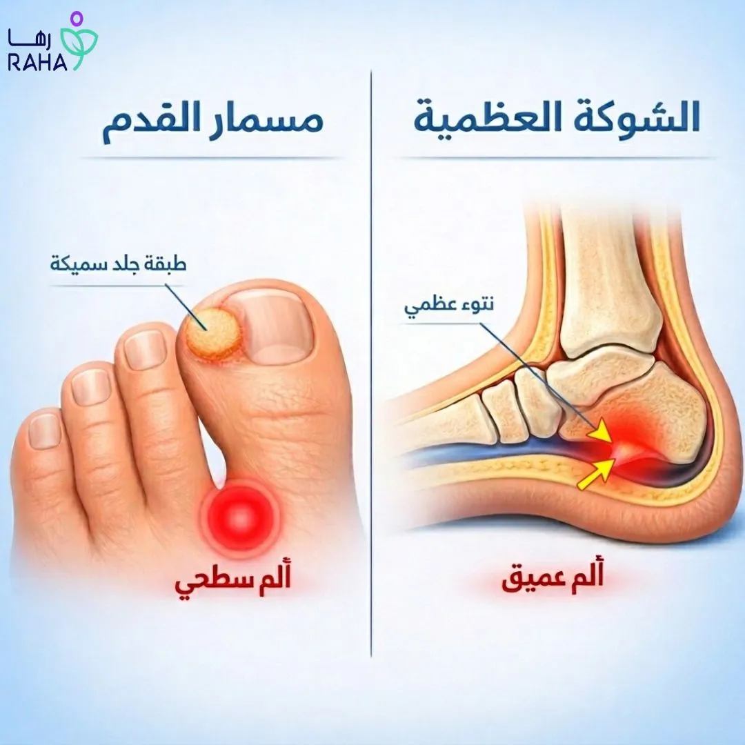 الفرق بين المسمار والشوكة العظمية